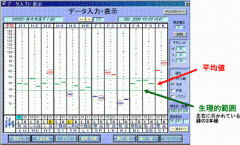 ノイロ